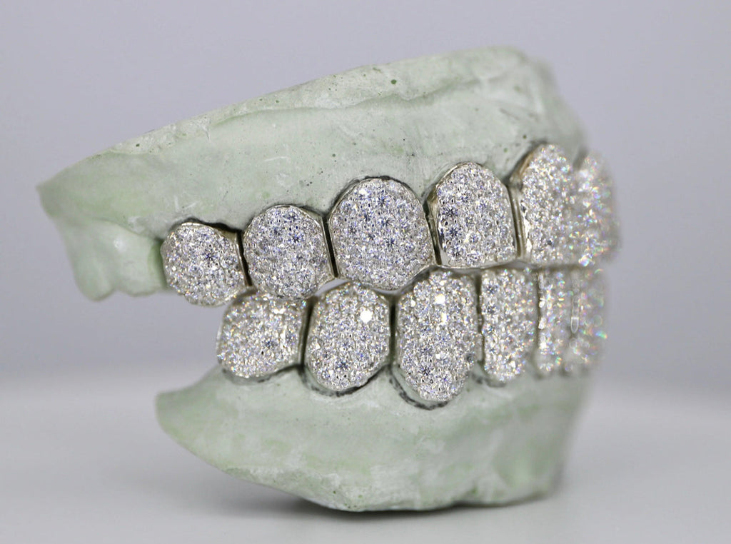 Vvs1 Moissanite Diamond Grillz