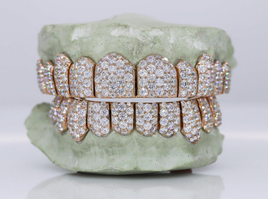 Vvs1 Moissanite Diamond Grillz