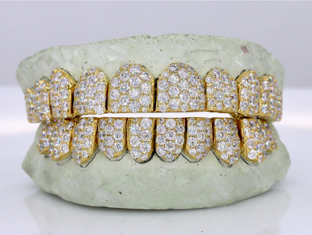 Vvs1 Moissanite Diamond Grillz