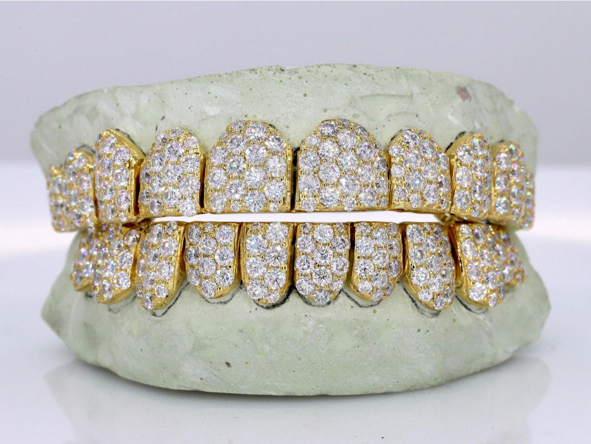 Vvs1 Moissanite Diamond Grillz
