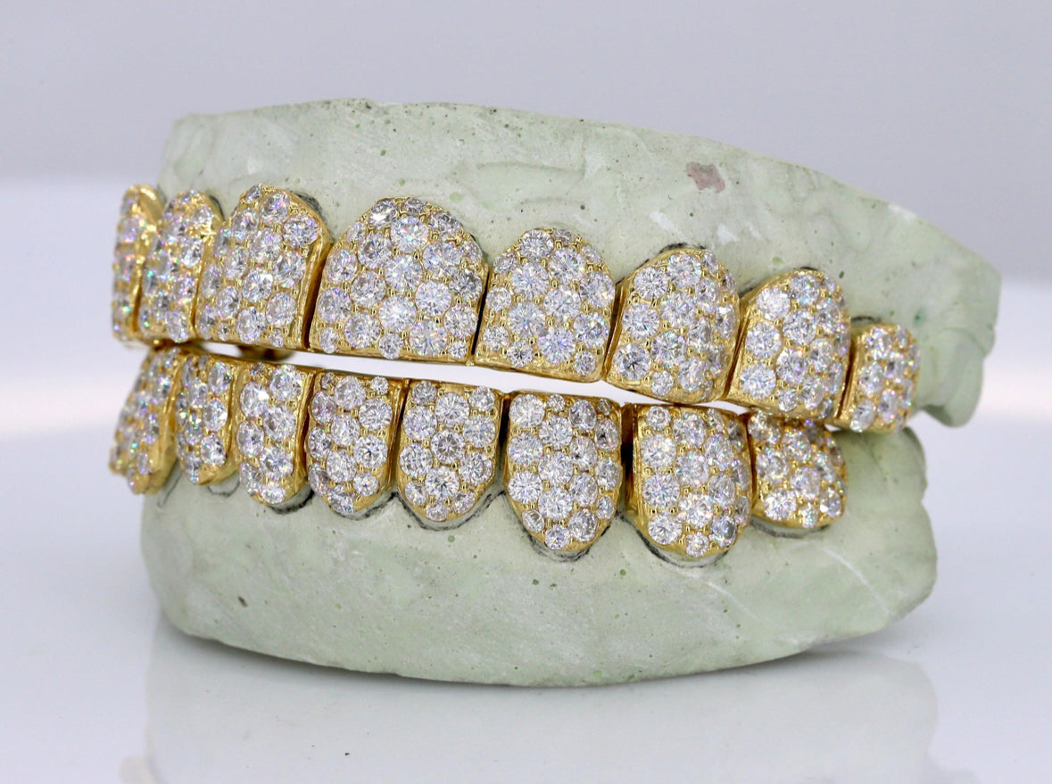 Vvs1 Moissanite Diamond Grillz