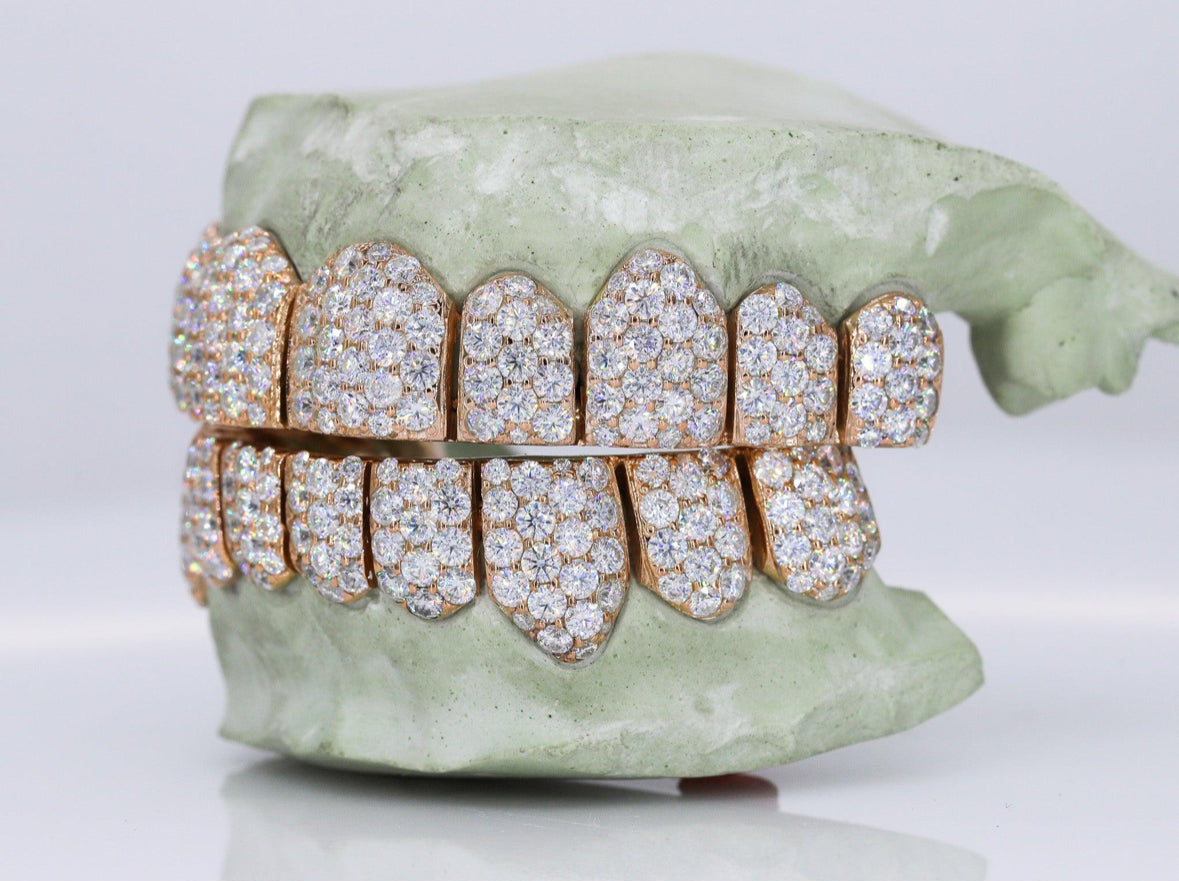 Vvs1 Moissanite Diamond Grillz