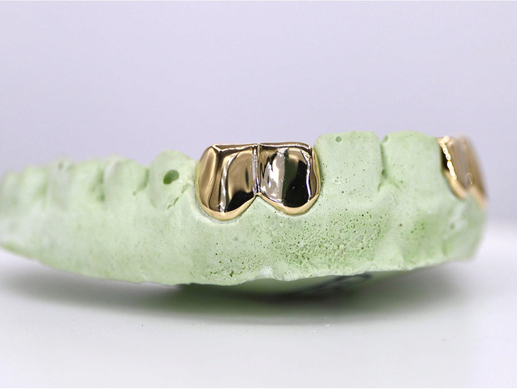 2 Solid 10k Solid Gold Grillz