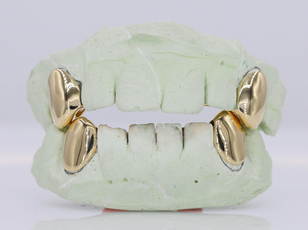 10k Gold Fangs Grillz