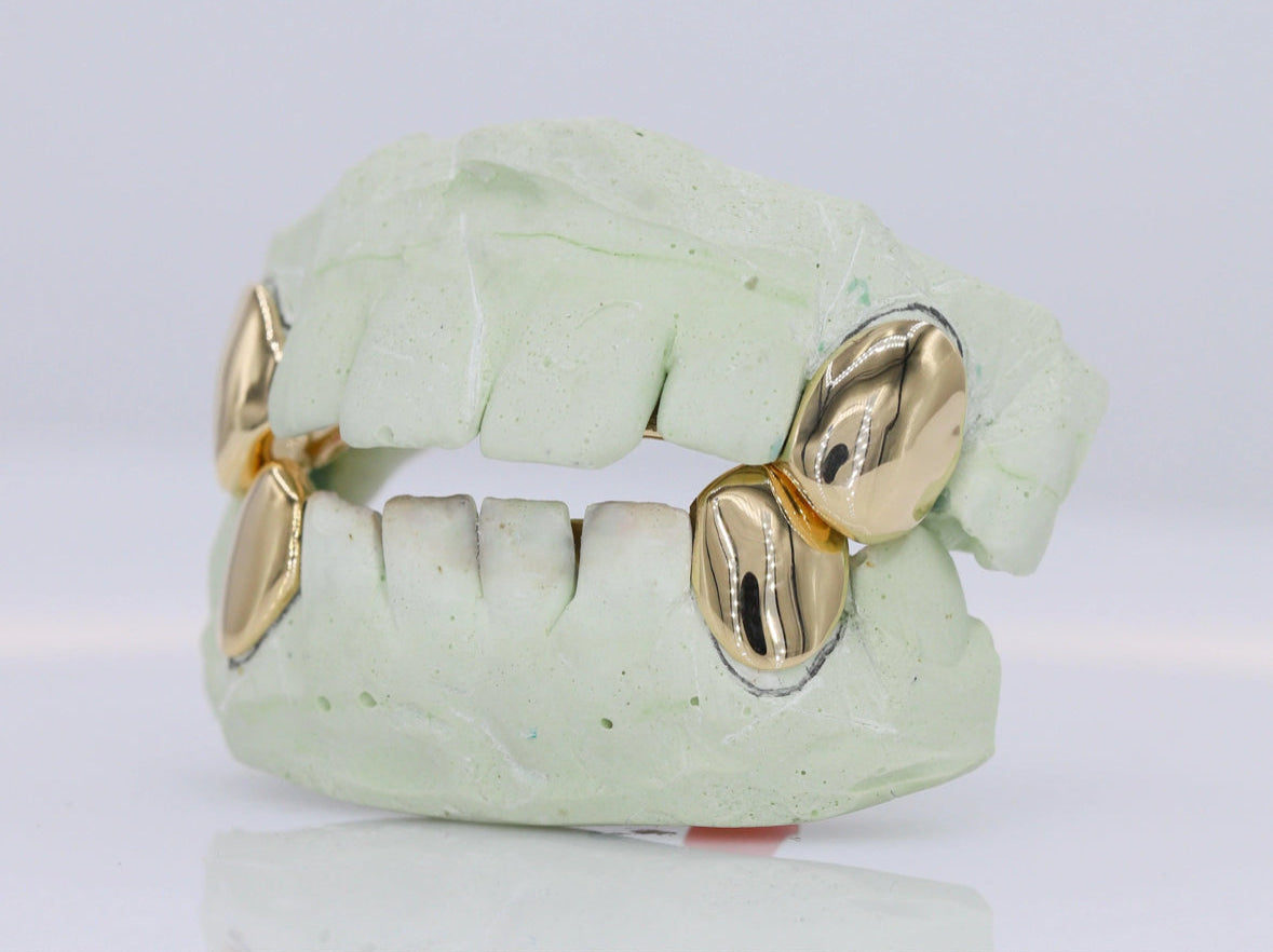 10k Gold Fangs Grillz