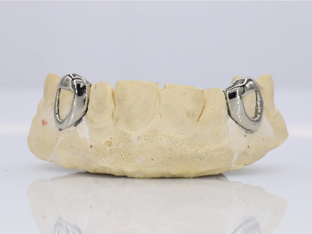 10k Open Face Fangs Grillz