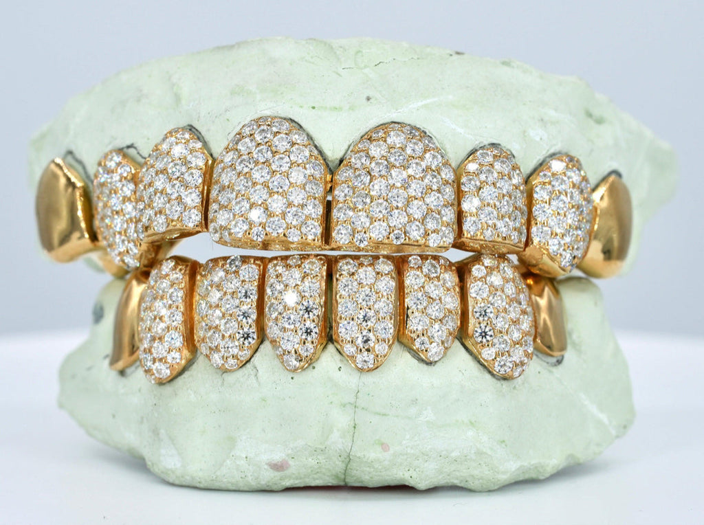 Capped Vvs1 Moissanite Diamond Grillz