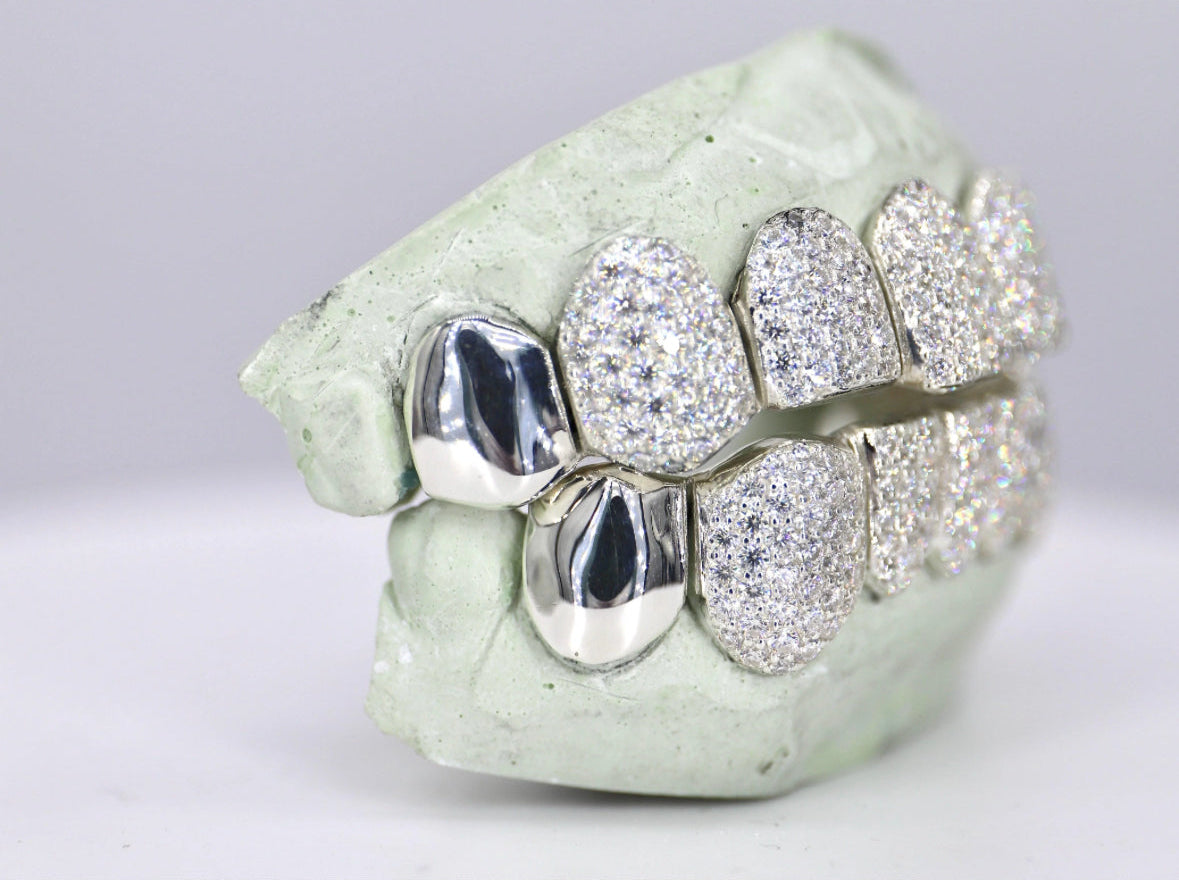 Capped Vvs1 Moissanite Diamond Grillz