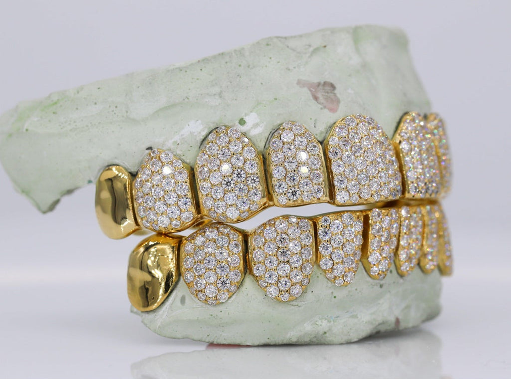 Capped Vvs1 Moissanite Diamond Grillz