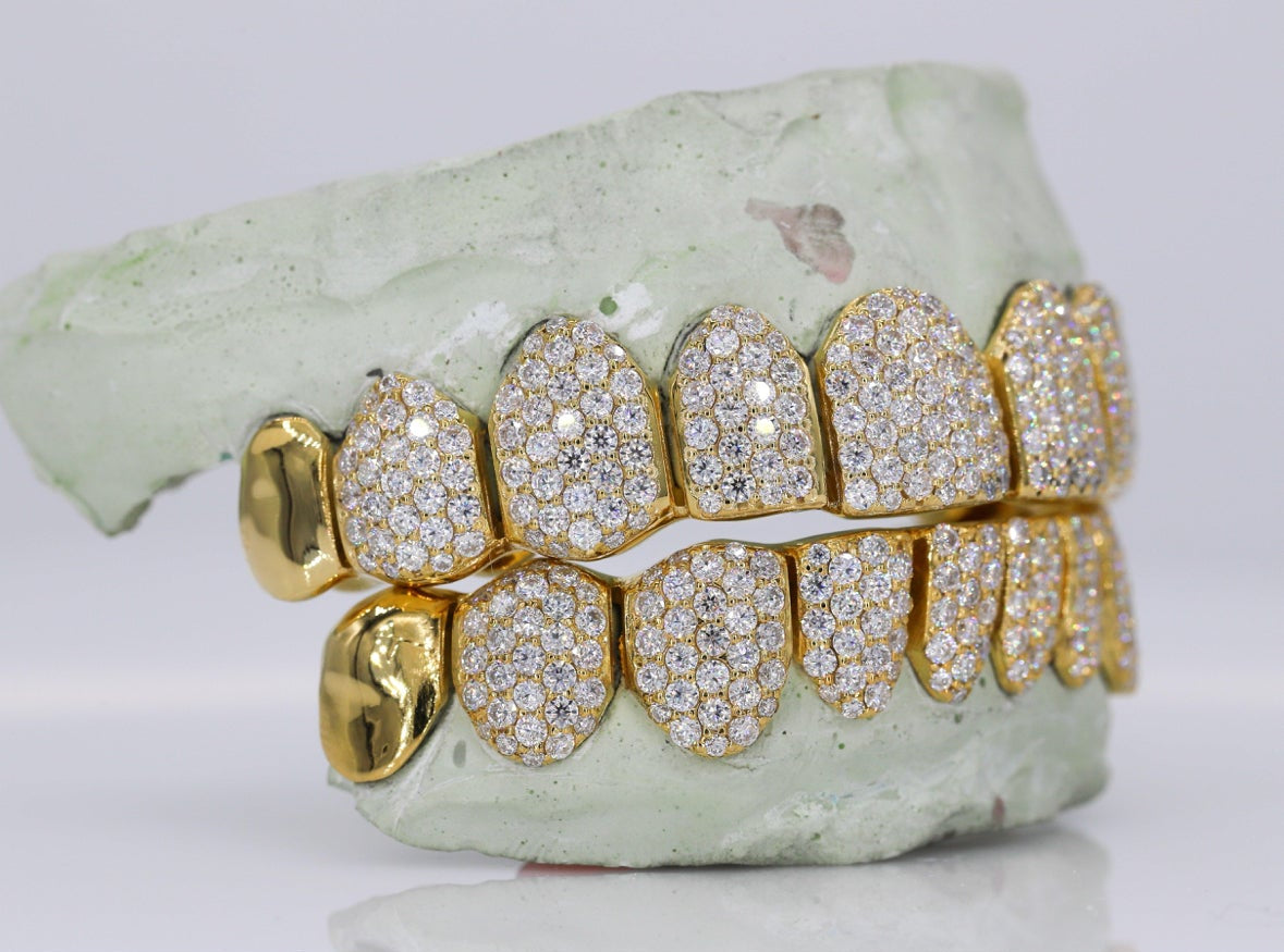 Capped Vvs1 Moissanite Diamond Grillz